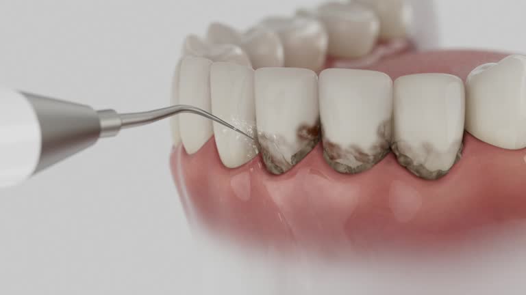 Reliable Dental contractor in Little Falls, MN by Dentist Open Now